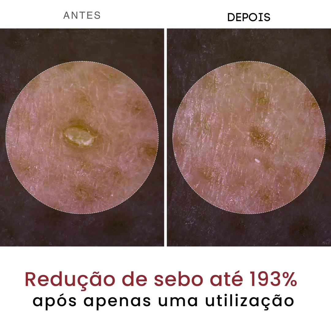 Pack de Peeling Coreano 2x1 - Esfoliação + Hidratação Profunda