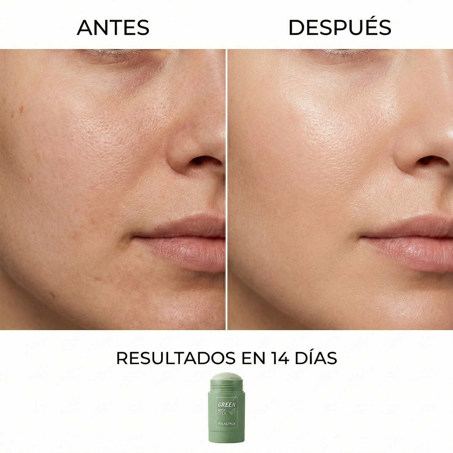 GREENSTICK™ - Máscara Hidratante (Produto Viral 2026)