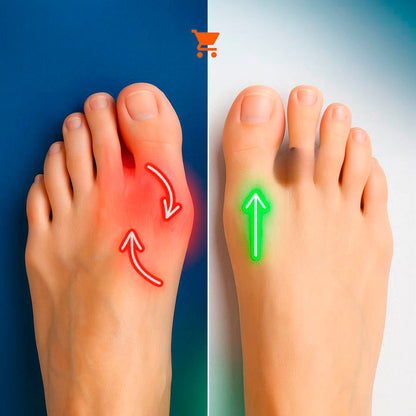 ToeRelief (2 unidades) - Bem-estar Total Para Seus Pés