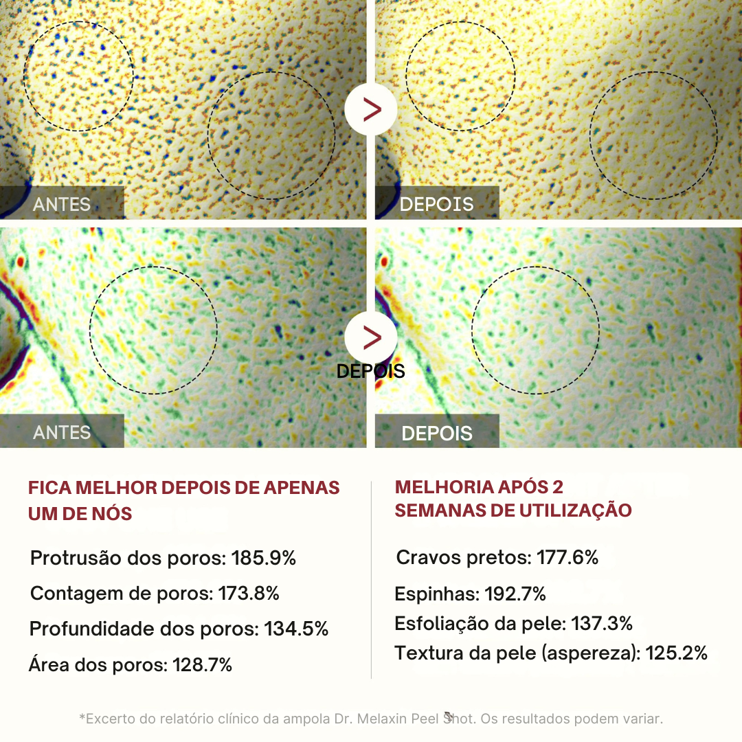 Pack de Peeling Coreano 2x1 - Esfoliação + Hidratação Profunda