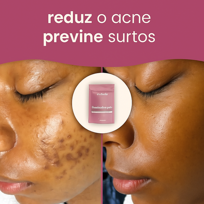 Almofadas iluminadoras de cúrcuma e ácido kójico